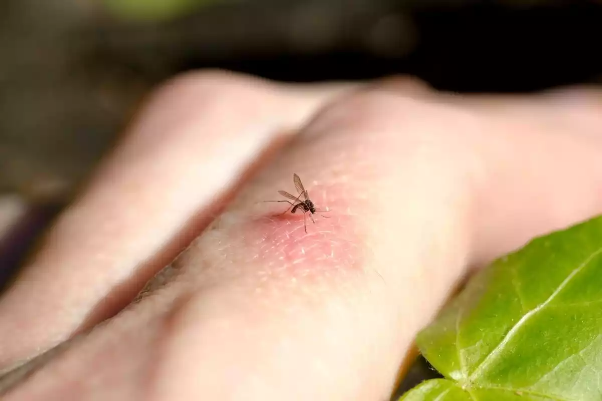 Un mosquito picando una mano y causando enrojecimiento