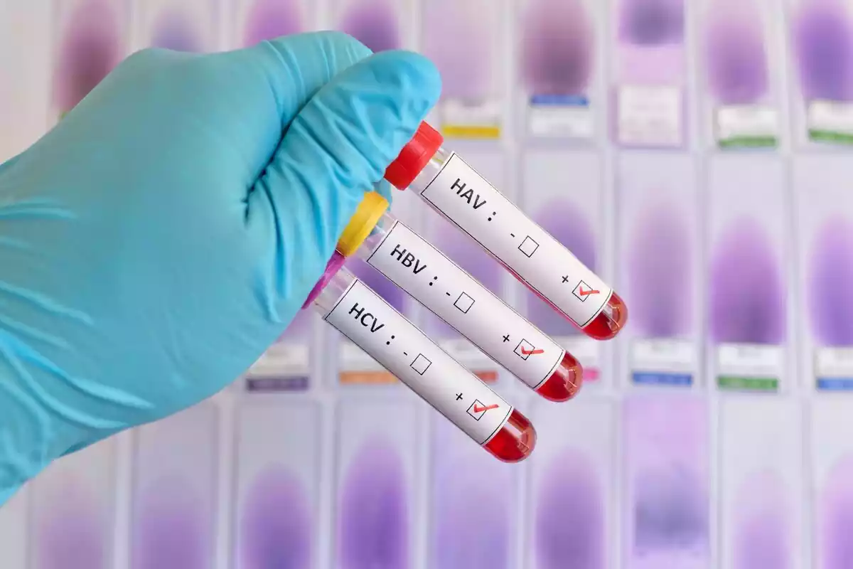 Tres test de hepatitis sujetados por un sanitario