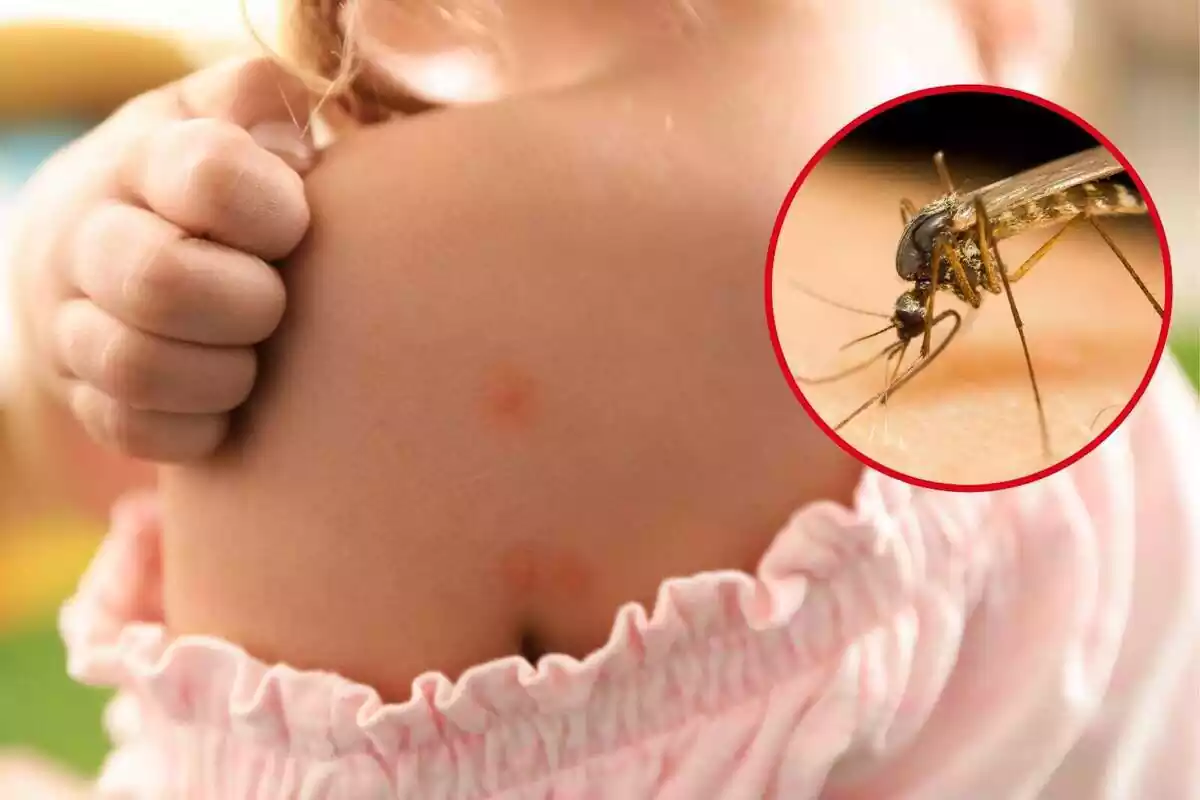 Montaje de una foto de una niña con picaduras de mosquitos y una imagen en un marco de un mosquito