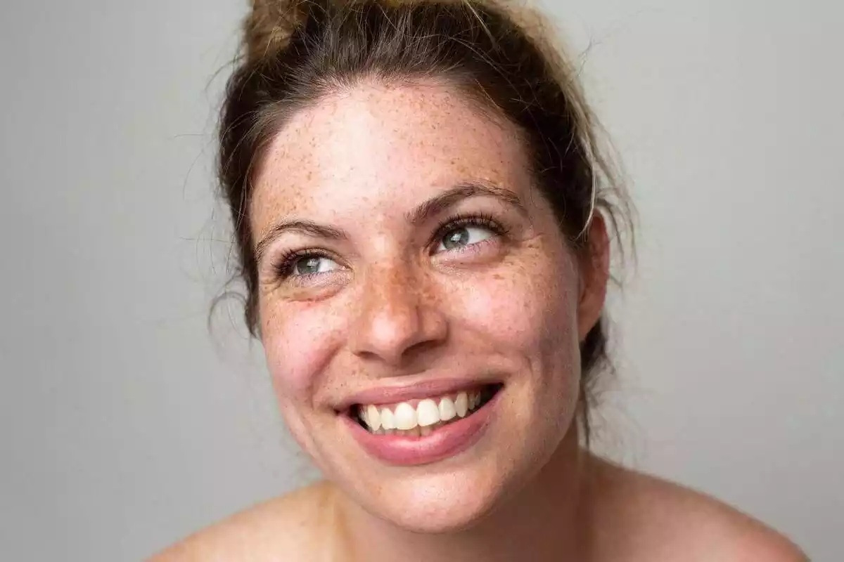 Mujer con una gran cantidad de pecas en su rostro, sonriendo