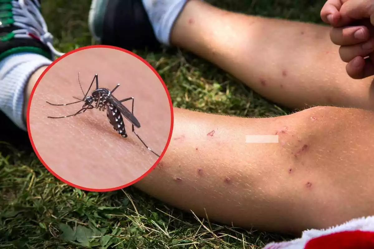 Montaje de una pierna de picaduras con un mosquito tigre
